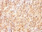 Anti-S100B Antibody